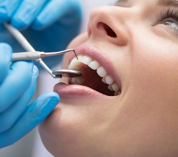 Hanford Dental Restoration