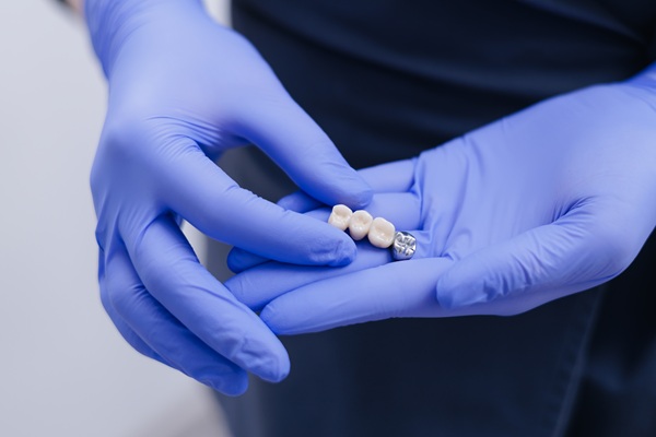 Is It Time For You To Get A Dental Bridge?