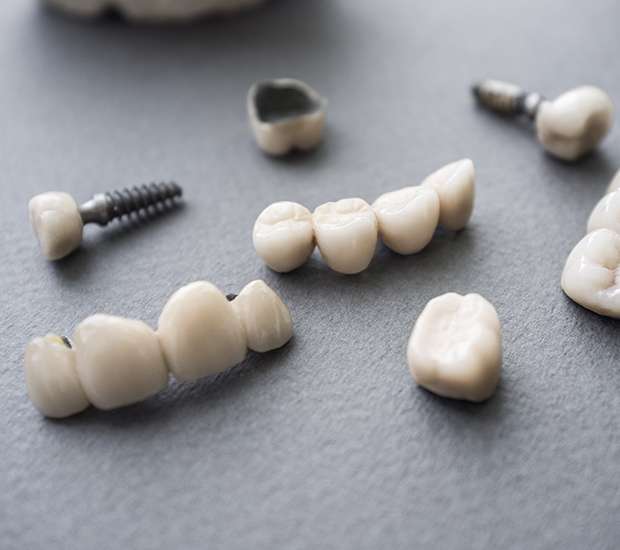 Hanford The Difference Between Dental Implants and Mini Dental Implants