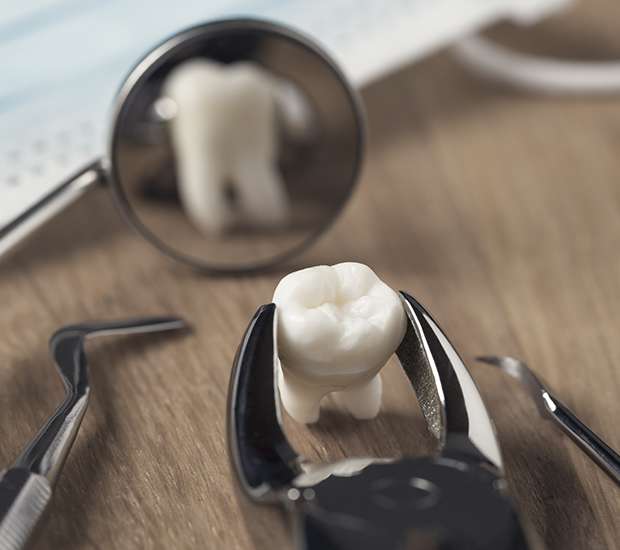 Hanford When Is a Tooth Extraction Necessary